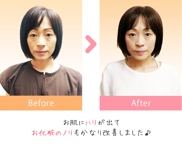 before after1